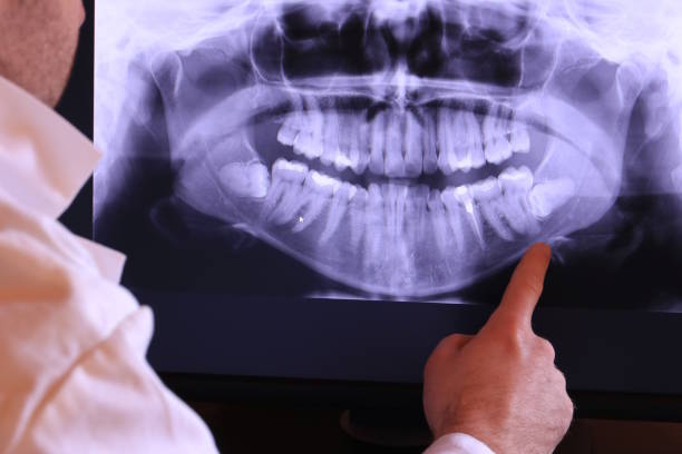 Best Emergency Treatment for Toothache in Cutten, CA