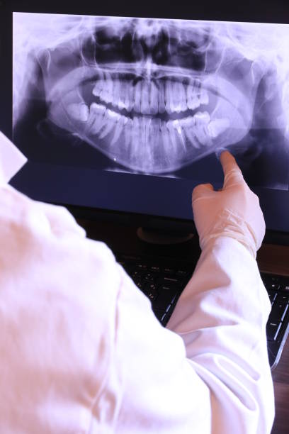 Best Emergency Tooth Extraction in Cutten, CA