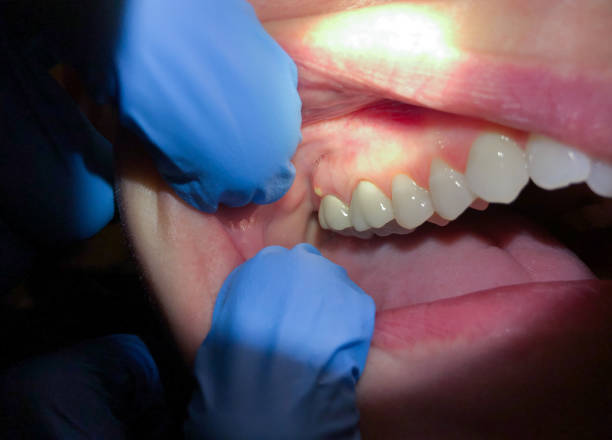 Best Emergency Treatment for Toothache in Cutten, CA