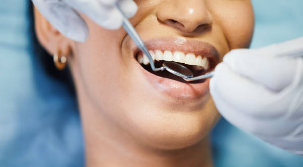 Best Emergency Treatment for Toothache in Cutten, CA