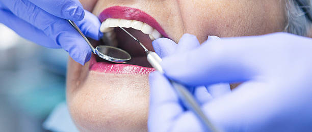 Best Emergency Treatment for Toothache in Cutten, CA