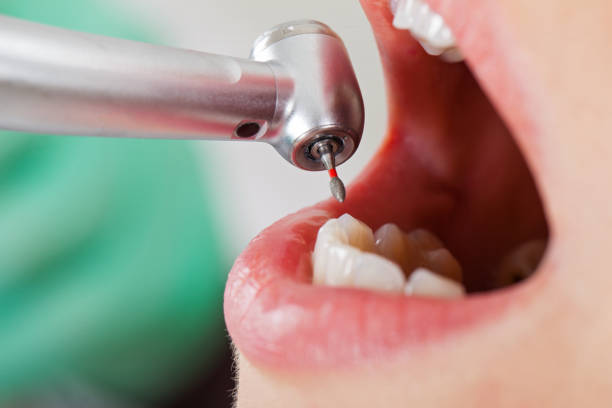 Best Emergency Dental Surgery in Cutten, CA